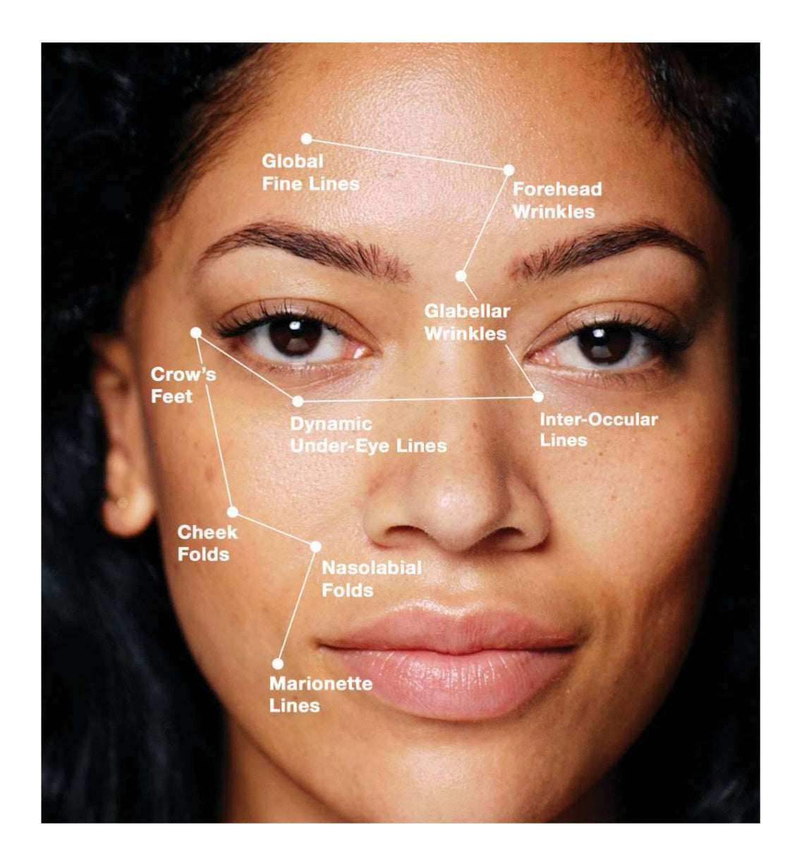 A dark glass dropper bottle of SKIN CEUTICALS P-TIOX serum stands upright on a white background with a reflection beneath, featuring product details for needle-free wrinkle correction.