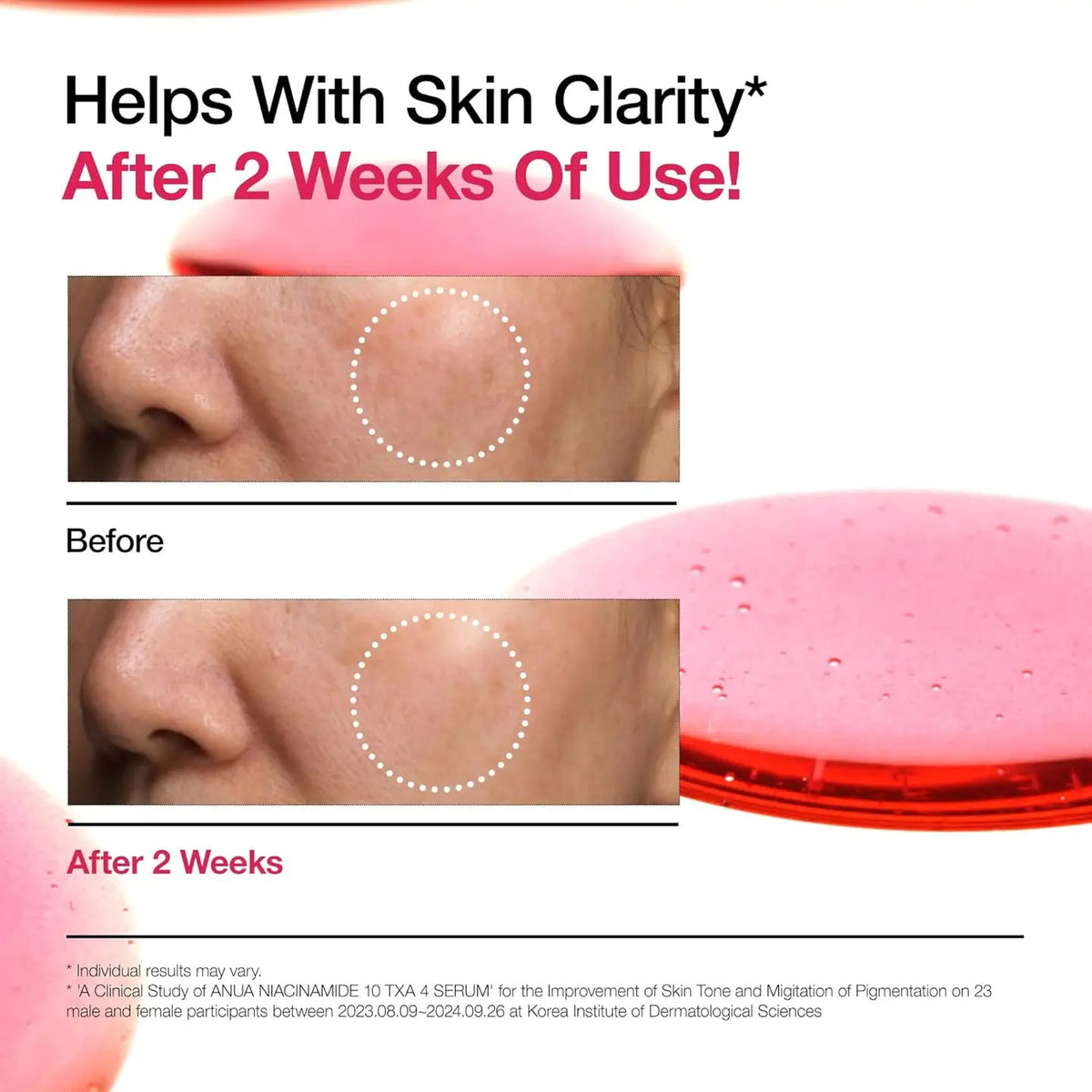 The GLOWISS ANUA serum features a pink liquid dropper with 10% Niacinamide for clear skin, Hyaluronic and Polyglutamic Acid for hydration, Ceramide to support the moisture barrier, and is fragrance-free. This &quot;Powerful Trio&quot; is designed for radiant skin.