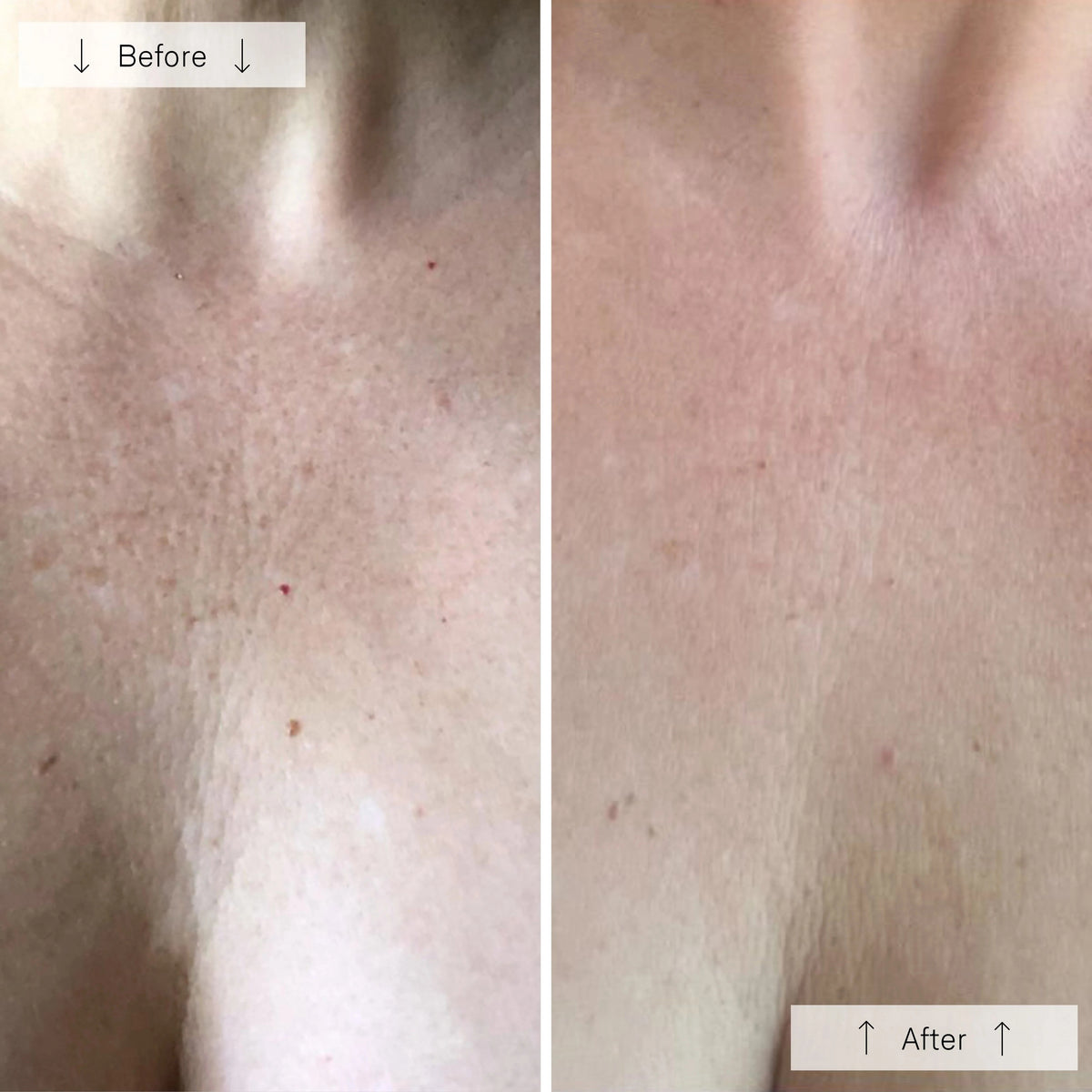 An OMNILUX - CONTOUR NECK & DECOLLETE KIT device by OMNILUX, featuring a white and pink pattern and designed for red light therapy, stands upright on a white surface with soft red light glowing around its edges.