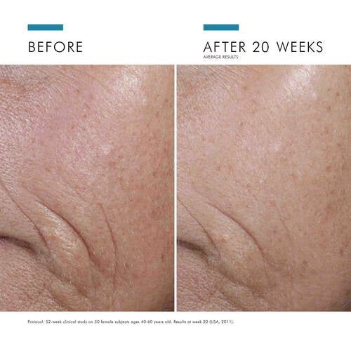 Image showing instructions for applying the SKINCEUTICALS - CE FERULIC serum in two steps:

Step 1: &quot;In the morning after cleansing, dispense 4-5 drops of SKINCEUTICALS - CE FERULIC into clean hands.&quot; (Photo of a person dropping serum onto their hand.)
Step 2: &quot;Gently press SKINCEUTICALS - CE FERULIC into the skin on your face, neck, and décolletage. Follow with any other skincare products and sunscreen for environmental protection.