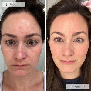 The OMNILUX - CONTOUR FACE MASK by OMNILUX, designed for skin rejuvenation and anti-aging, features red light therapy technology. It has adjustable straps, cutouts for eyes, nose, mouth, and a geometric green-white pattern on a plain white background.