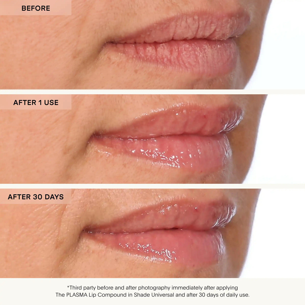 A woman uses U BEAUTY's PLASMA LIP COMPOUND IN TUILLE with a pen-like applicator. Clinical results: 100% see improved hydration, 93% notice fewer lines/wrinkles, and 97% experience fuller-looking lips.