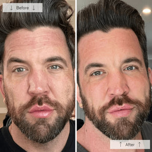 A man intently examines the OMNILUX - MENS MASK, a glowing red LED mask designed for skin rejuvenation with advanced red light therapy, featuring eye, nose, and mouth cutouts.